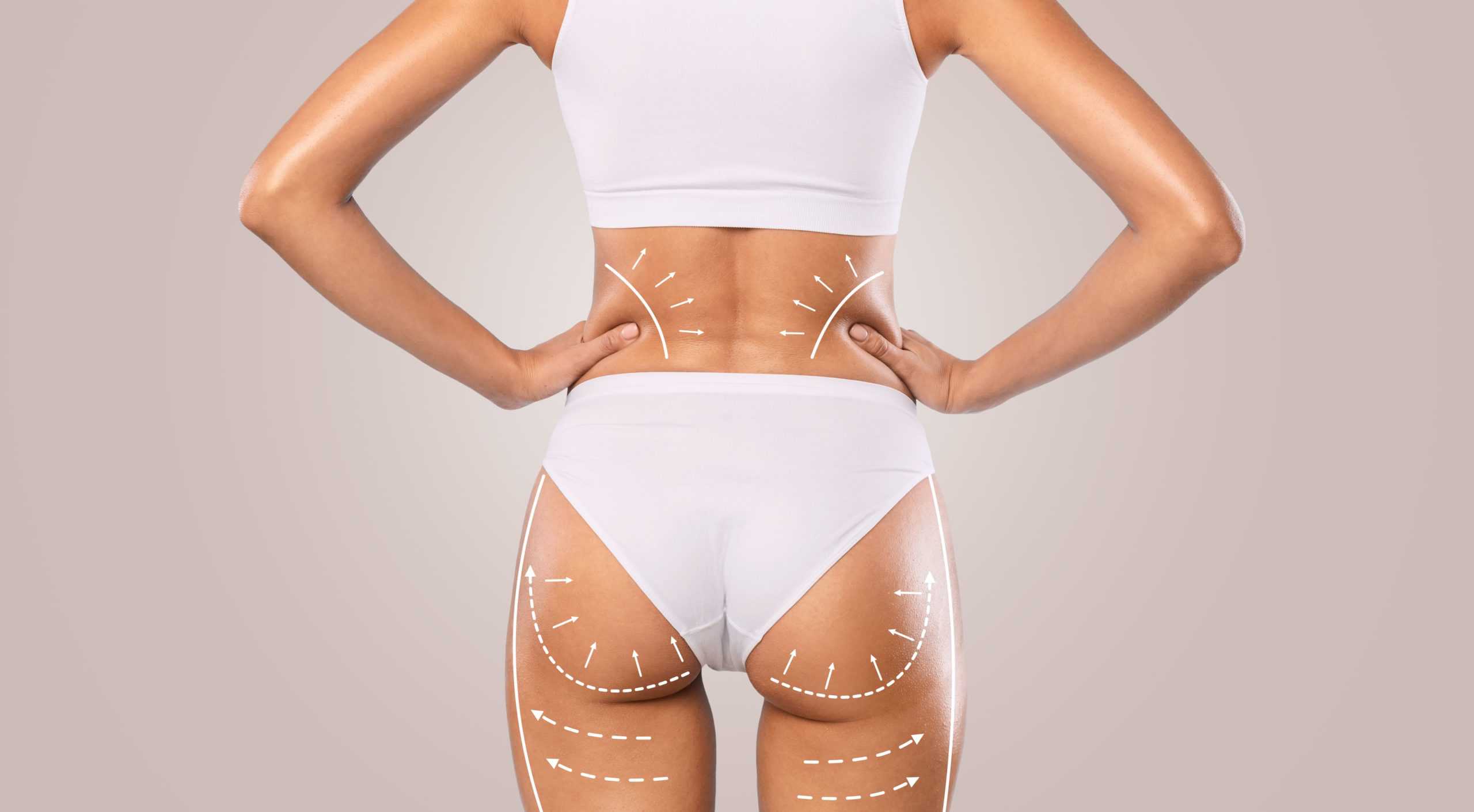 The Benefits Of Non Surgical Body Sculpting - Glow Medispa