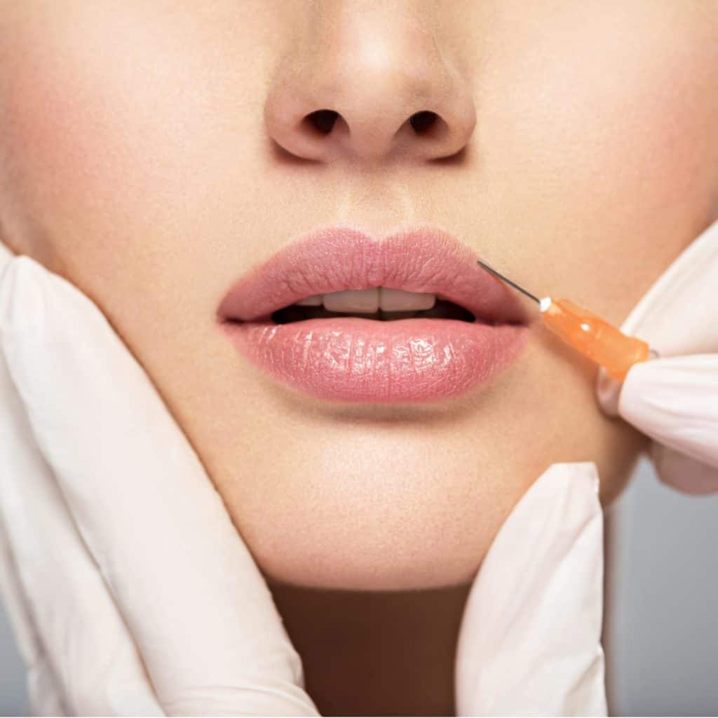 Portfolio 1 woman having lip injections, a prick of a syringe for the beauty lips. lip augmentation | Glam Bar Medical Spa in Los Angeles CA