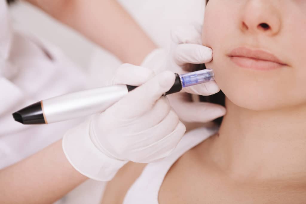 Portfolio 7 Cropped close up of unrecognizable woman getting mesotherapy procedure at beauty clinic | Glam Bar Medical Spa in Los Angeles CA